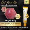 4 Tuýp gel nano bạc hỗ trợ làm sạch sùi mào gà lở loét viêm nặng
