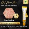 3 Tuýp gel nano bạc điều trị viêm nang lông viêm chân lông